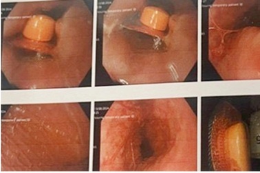 Hà Nội: Bệnh nhân nhập viện cấp cứu vì tai nạn không ngờ khi uống thuốc