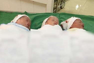 Ca sinh 3 tự nhiên hiếm gặp tại Nghệ An