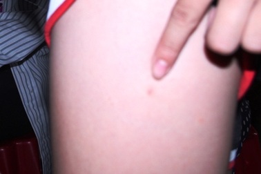 Học sinh bị đâm vật nhọn dính máu HIV có lây bệnh?