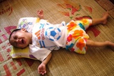 Sự sống mong manh của bé 14 tháng tuổi mắc bệnh bại não   