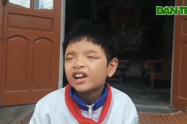 Bi đát học sinh lớp 5 mù mắt ở Nghệ An