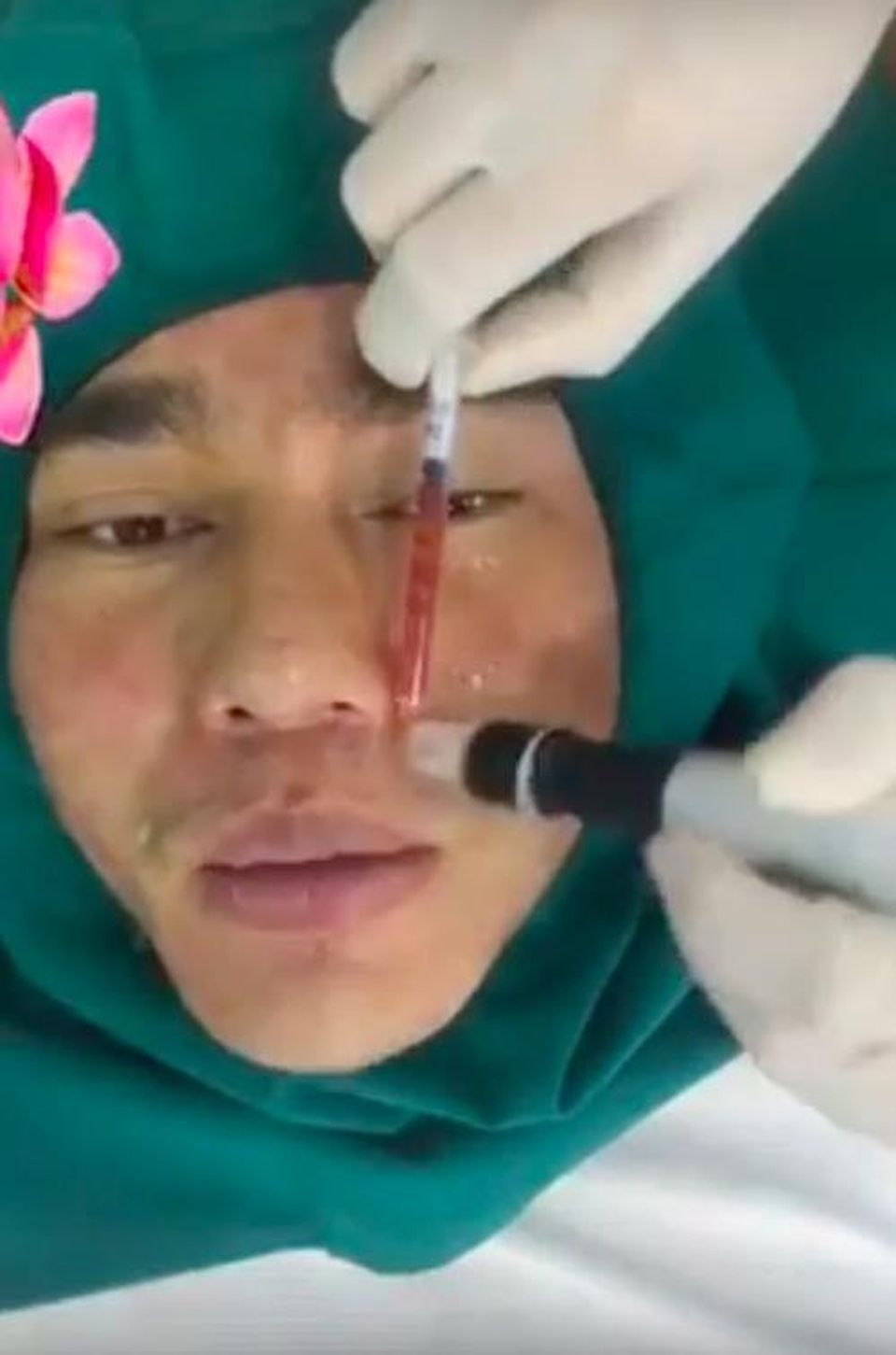 3 sao Việt dao kéo cả mặt, thậm chí có người “chỉ còn lỗ tai chưa thẩm mỹ” - 1 3 sao Việt dao kéo cả mặt, thậm chí có người “chỉ còn lỗ tai chưa thẩm mỹ” - 1