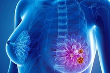 Sờ thấy u ở nách có phải mắc ung thư vú?