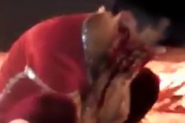 Người bị cá sấu cắn vào mặt không phải diễn viên của Liên đoàn Xiếc