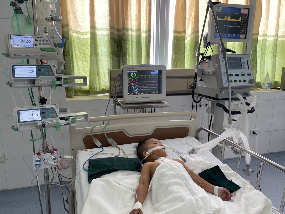 Bé 3 tuổi mắc tim bẩm sinh và đa dị tật đã được phẫu thuật - 4 Bé 3 tuổi mắc tim bẩm sinh và đa dị tật đã được phẫu thuật - 4