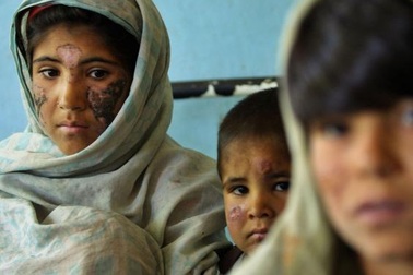 Bệnh ăn mòn da đe dọa Trung Đông