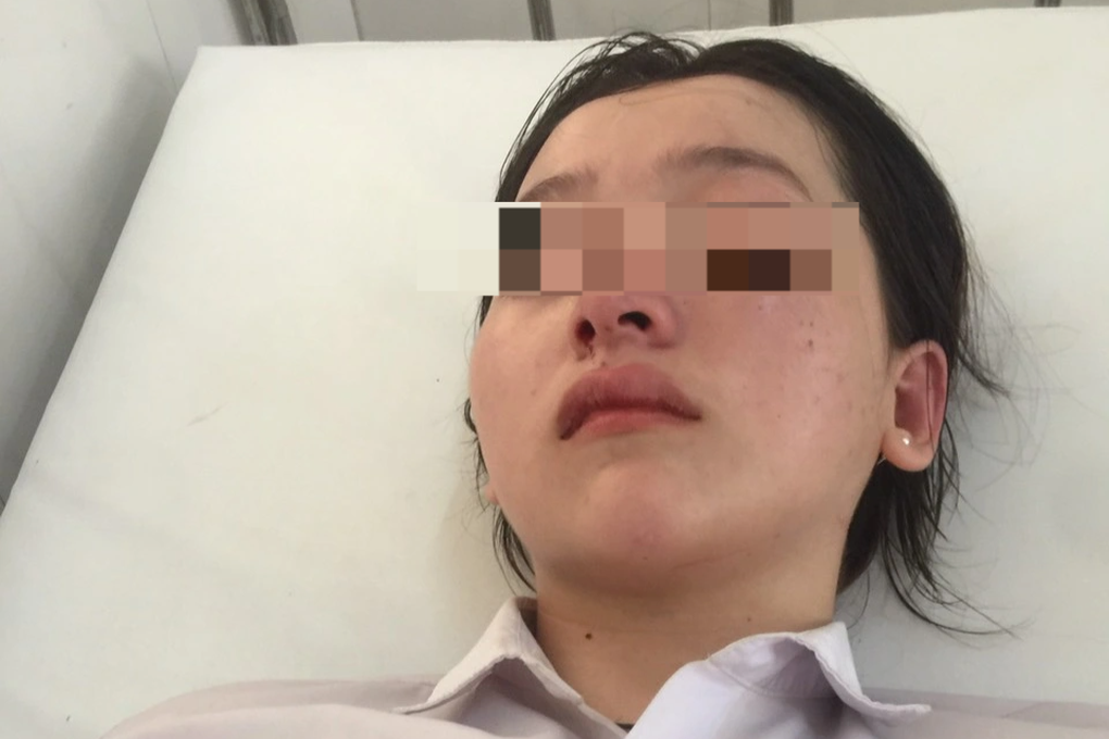 Nữ sinh miền Tây bị 7 người đánh hội đồng gãy xương mũi, chấn thương đầu - 2 Nữ sinh miền Tây bị 7 người đánh hội đồng gãy xương mũi, chấn thương đầu - 2