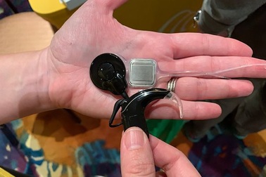 Ốc tai điện tử đặc biệt giúp lấy lại thính lực cho người bị điếc