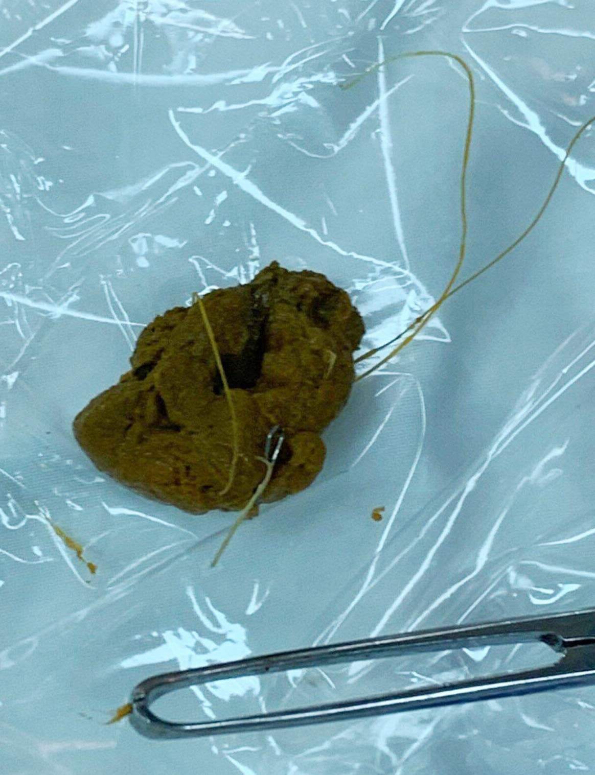 Ăn cá, nuốt luôn cả lưỡi câu và dây câu vào bụng - 2 Ăn cá, nuốt luôn cả lưỡi câu và dây câu vào bụng - 2