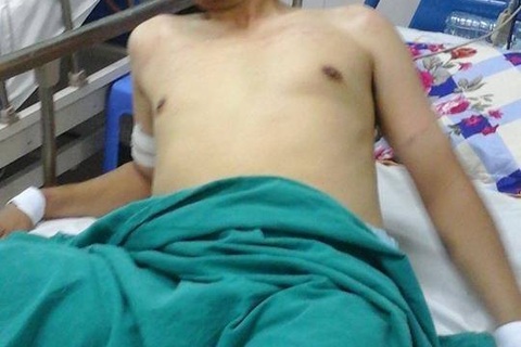 Bị trói trên giường vì hoảng hốt thấy quái vật, rắn rết trong phòng bệnh