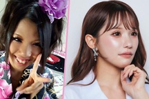 Cô gái chấp nhận "20 lần đau đớn" vì bị mẹ chê xấu