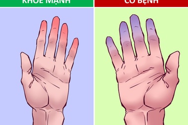 30 giây kiểm tra sức khỏe tim mạch tại nhà chỉ với một tô nước đá