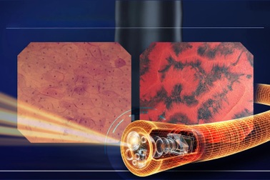 Endocyto 520x: Vai trò trong chẩn đoán và định hướng phát triển nội soi tiêu hóa