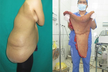 Những ca bệnh hi hữu khiến các bác sĩ phải nhớ mãi