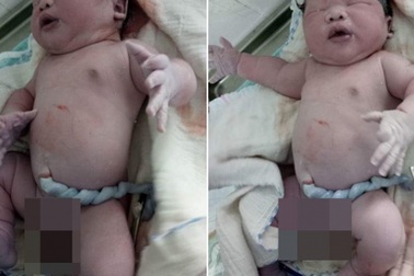 Kinh ngạc trước những em bé vừa chào đời đã có cân nặng “khủng” nhất Việt Nam