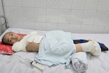 Đau nhói lòng cảnh cậu bé bị dòng điện cao thế cướp đi tương lai