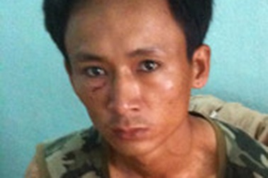 Bắt tên trộm nuốt vàng vào bụng