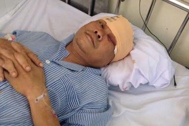 Bắt đối tượng chém trọng thương một Trung tá công an