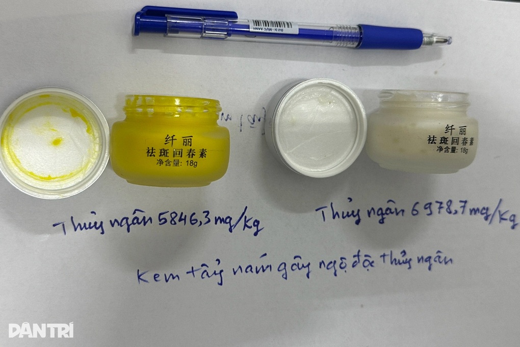 Dùng kem chống nám mua trên mạng, bệnh nhân hôn mê vì nhiễm độc thủy ngân - 2 Dùng kem chống nám mua trên mạng, bệnh nhân hôn mê vì nhiễm độc thủy ngân - 2