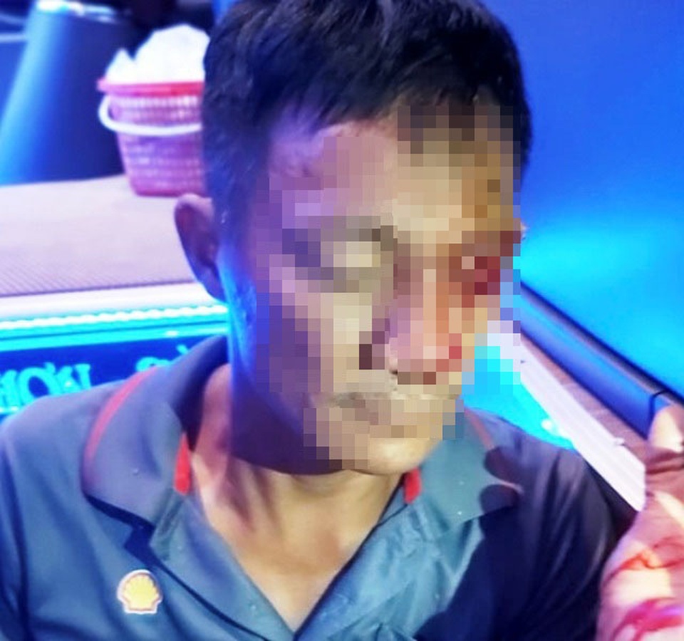 Lời kể của phụ xe khách bị chĩa súng, bắn vào mặt - 1 Lời kể của phụ xe khách bị chĩa súng, bắn vào mặt - 1