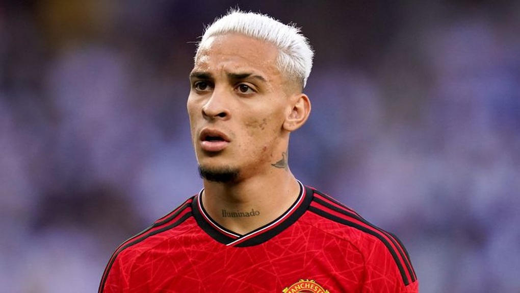 Man Utd báo tin cực vui, HLV Ten Hag mừng khôn xiết - 1 Man Utd báo tin cực vui, HLV Ten Hag mừng khôn xiết - 1