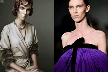 Sốc với vẻ hốc hác của siêu mẫu... siêu gầy