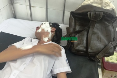 Nghi án 2 nữ sinh viên bị tạt axit vì ghen tuông