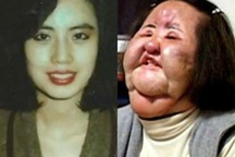 Cuộc đời bi kịch vì cuồng phẫu thuật thẩm mỹ của nữ ca sĩ Hàn Quốc