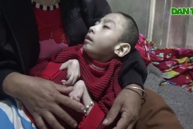 Cậu bé biến dạng cơ thể sau 15 năm nằm một chỗ