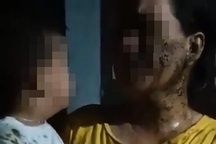 Phẫn nộ hành động đổ phân lên người bé 2 tuổi vì mâu thuẫn giữa người lớn