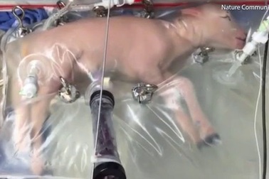 Mục sở thị hoạt động của tử cung nhân tạo