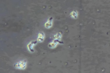 Hàn Quốc ghi nhận ca tử vong đầu tiên vì nhiễm ký sinh trùng "ăn não"