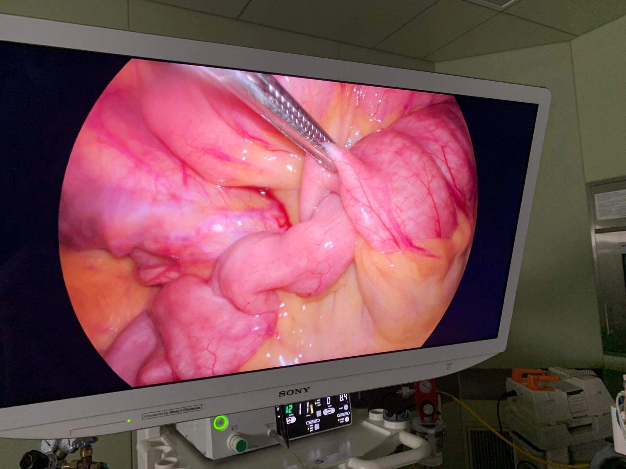 Ăn cá, nuốt luôn cả lưỡi câu và dây câu vào bụng - 1 Ăn cá, nuốt luôn cả lưỡi câu và dây câu vào bụng - 1