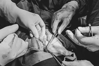 “Ma men” mất ruột non vì nhậu xỉn vẫn lái xe