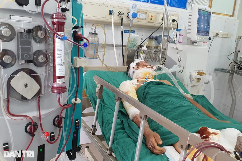 Xin cứu giúp chàng trai nghèo hiếu thảo bị phóng điện như ngọn đuốc sống - 4 Xin cứu giúp chàng trai nghèo hiếu thảo bị phóng điện như ngọn đuốc sống - 4