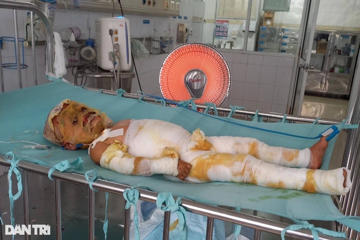 Bé 3 tuổi bị nhấn chìm trong ngọn lửa hung dữ cầu xin được cứu sống - 2 Bé 3 tuổi bị nhấn chìm trong ngọn lửa hung dữ cầu xin được cứu sống - 2