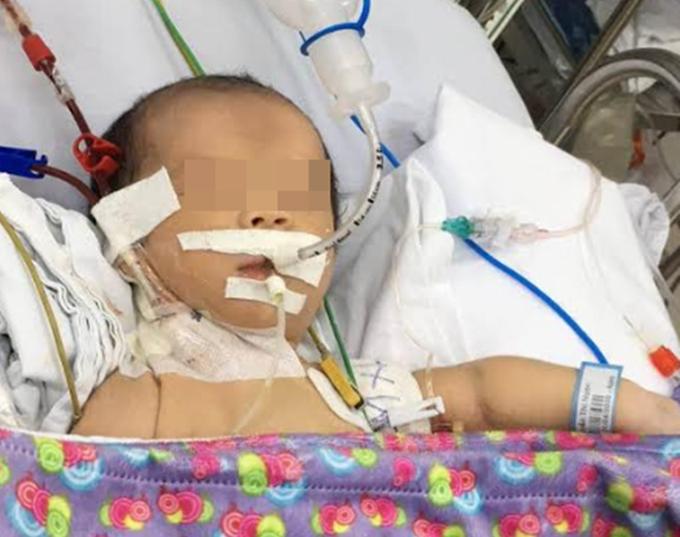 TP.HCM: Bé trai 3 ngày tuổi đột nhiên bỏ bú rồi co giật, rơi vào hôn mê khiến bố mẹ chết lặng - Ảnh 1. TP.HCM: Bé trai 3 ngày tuổi đột nhiên bỏ bú rồi co giật, rơi vào hôn mê khiến bố mẹ chết lặng - Ảnh 1.
