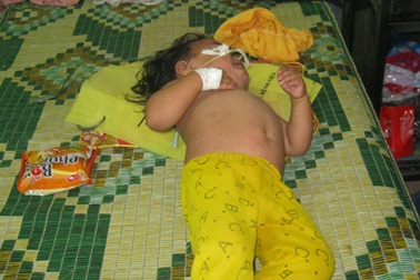 Cứu sống trẻ 4 tuổi bị nhiễm trùng uốn ván