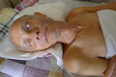 Người đàn ông vô danh đã được các con đón về nhà