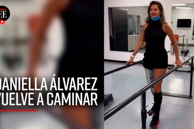 Daniella Álvarez - Hoa hậu bị cưa chân của Colombia