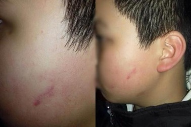 Để 43 học sinh tát 1 em, cô giáo quên “tình thương và trách nhiệm”?