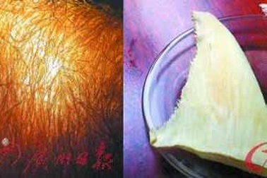 Vi cá mập giả tràn lan từ chợ đến nhà hàng nổi tiếng