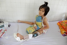 Bị tai nạn giao thông, bố và con gái 7 tuổi có nguy cơ mất chân