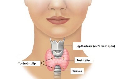 Xét nghiệm nào chẩn đoán ung thư tuyến giáp?