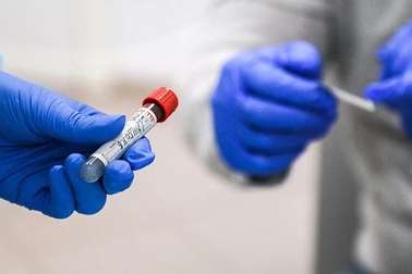 Tìm thấy xúc tu nguy hiểm trong cấu tạo của SARS-CoV-2