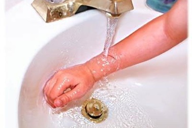 Các nguyên tắc không thể bỏ qua khi sơ cứu bỏng