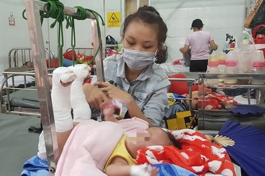 Bé 4 tháng tuổi nghi bị cha bạo hành gãy chân, xuất huyết não