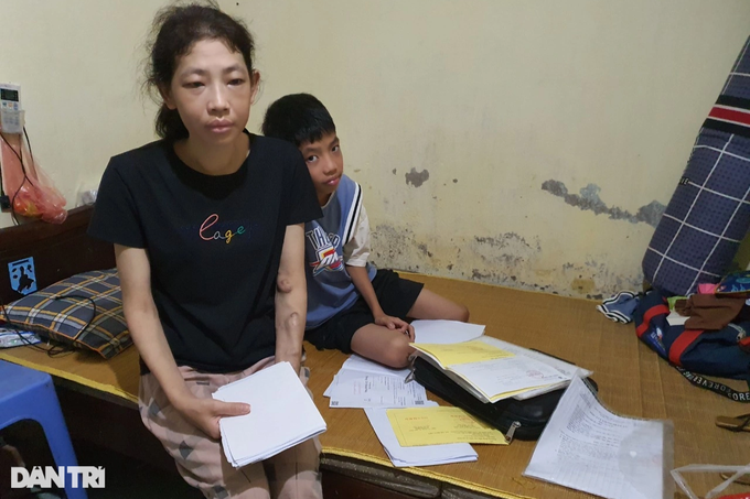 Mẹ suy thận giai đoạn cuối cầu xin cứu con trai mắc bệnh tim nặng - 4 Mẹ suy thận giai đoạn cuối cầu xin cứu con trai mắc bệnh tim nặng - 4