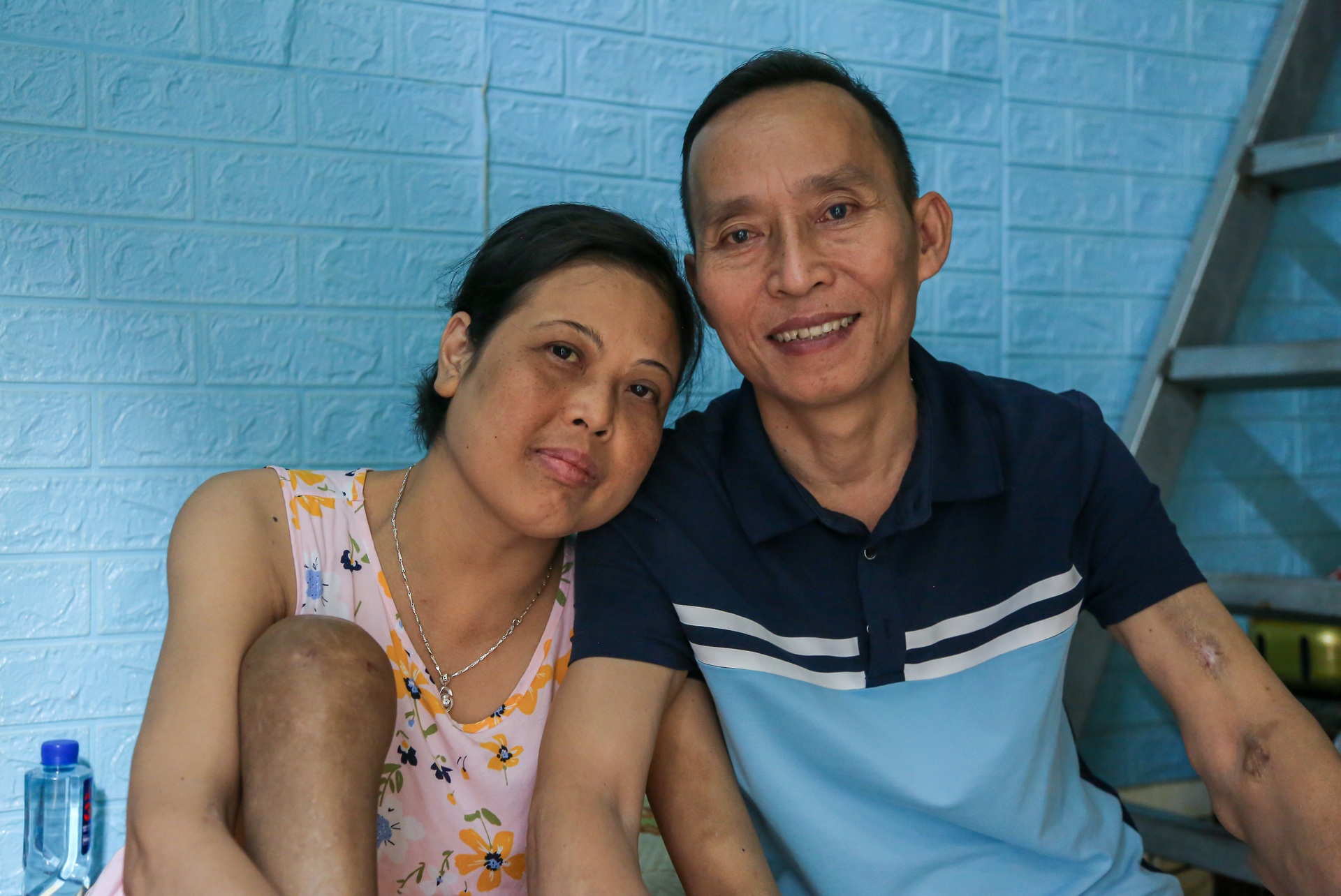 Những gia đình cùng kiệt vì viện phí, mẹ bán nhà đổi vài năm sống cho con - 1 Những gia đình cùng kiệt vì viện phí, mẹ bán nhà đổi vài năm sống cho con - 1