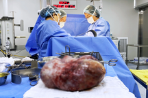 Bé gái 15 tuổi như bà bầu sắp sinh, phải cắt buồng trứng vì căn bệnh hiểm